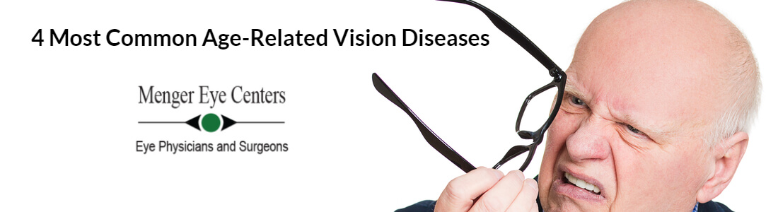 4 Most Common Age-Related Vision Diseases or Problems